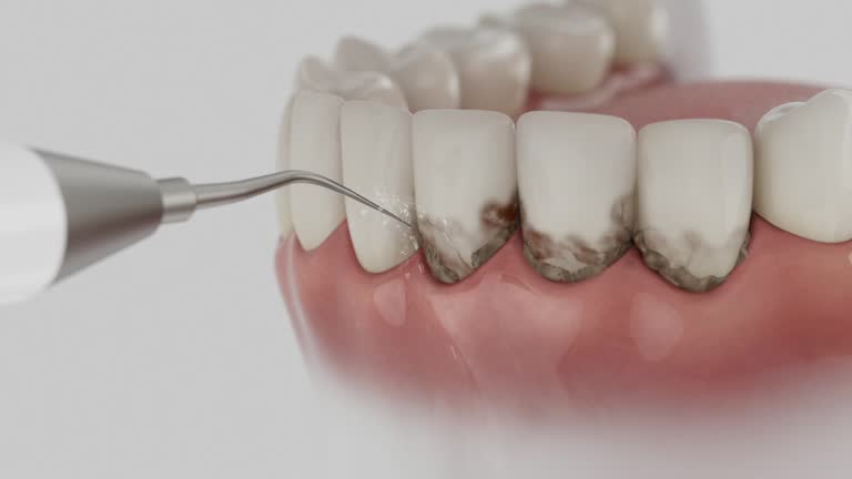 Trusted Root Canal Treatment service in Nanticoke, PA - Dentist Open Now